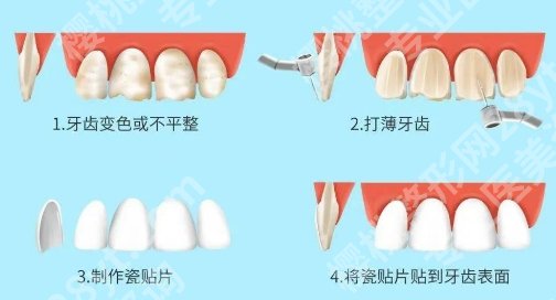 安徽省第二人民医院口腔科看牙怎么样?医院人气项目介绍