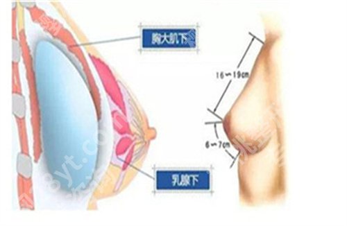 深圳美莱隆胸大概要多少钱?价格表在线看,医院