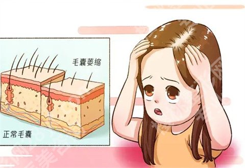广东省人民医院植发科技术好不好?案例反馈