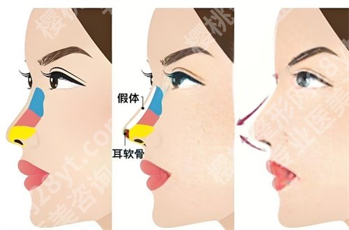 清华大学玉泉医院美容中心简介公布,带大家查看项目
