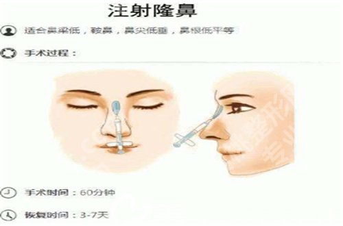 北京协和医院做双眼皮价格一览,基本信息已经揭晓了