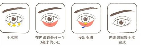 上海第六人民医院割眼袋多少钱?一览医院人气医生团队