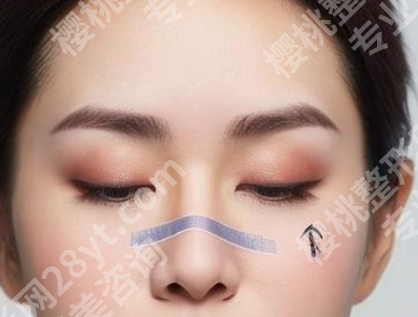 范荣杰医生案例怎么样?详细案例速来看看