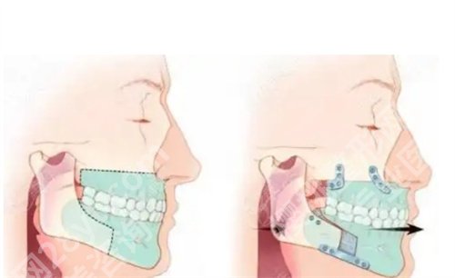 首尔丽格整形医院凸嘴手术做的怎么样?看医院简介内容