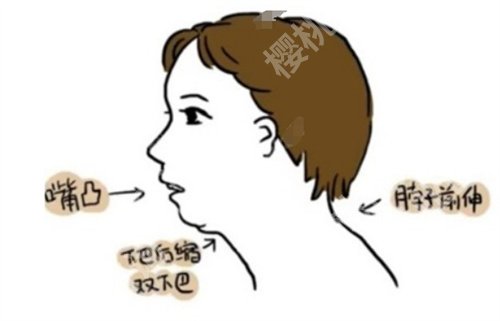 首尔丽格整形医院凸嘴手术做的怎么样?看医院简介内容