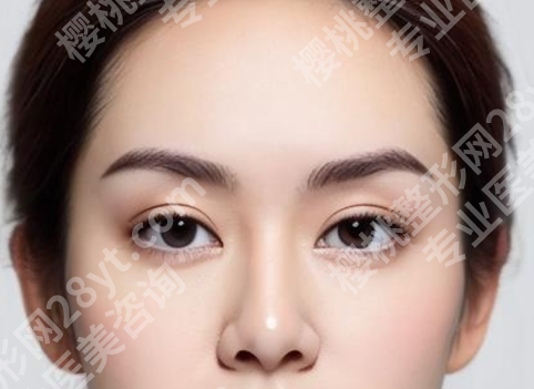 南医大友谊整形医院做鼻综合怎么样?核心项目详细分享与参考价格了解
