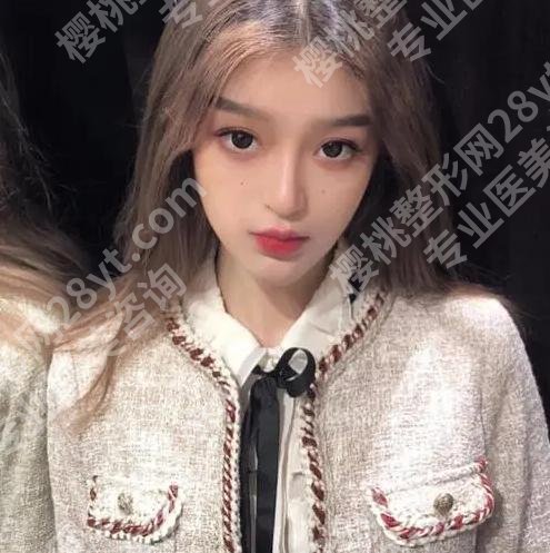 南京友谊整形做腰腹吸脂好吗?戳进来看看案例详情