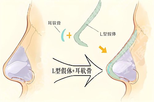 哈尔滨医大一院光子嫩肤做的怎么样?详情介绍+顾客点评