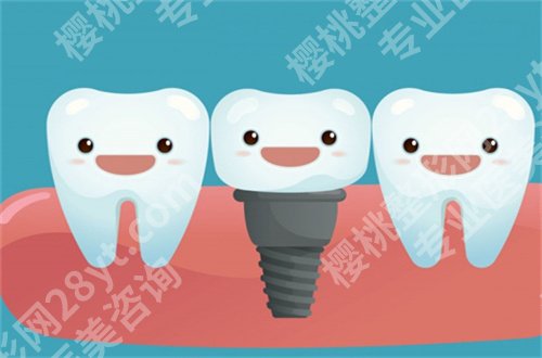 柳州人民医院种植牙费用告知,价格表公布,看人气医生