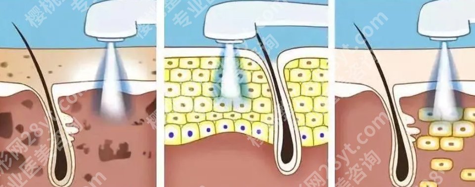 益阳格莱美美容医院正规吗?医院开展的项目有哪些?