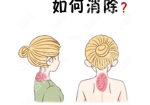 上海九院富贵包手术挂什么科?医院信息及医生信息公布