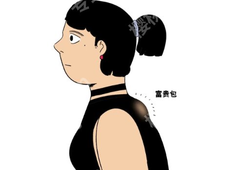 上海九院富贵包手术做的好吗?真实案例公布啦!