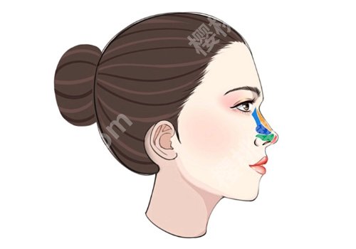上海华美整形鼻部整形多少钱?医院技术优势、地址一览