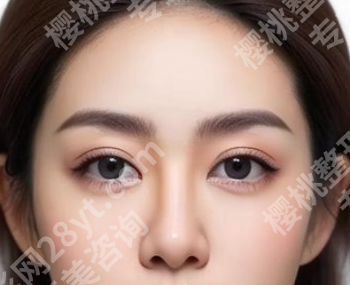 杨龙艺做双眼皮怎么样?附有热门医生简介,含口碑点评详情