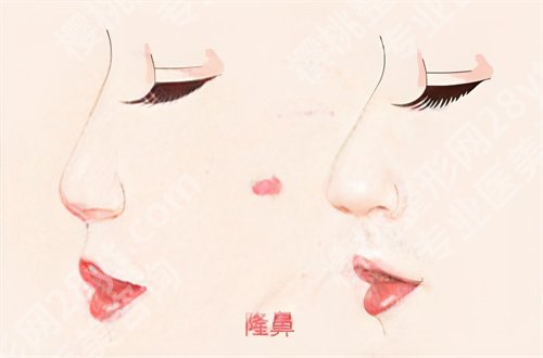 广东美恩整形美容医院怎么样?看用户反馈和环境