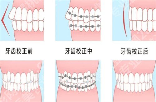 青苗口腔正规吗?医院简介+项目推荐