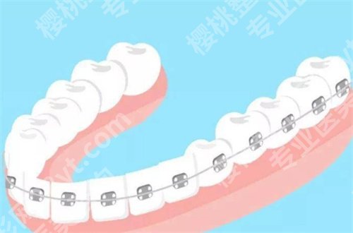 青苗口腔正规吗?医院简介+项目推荐