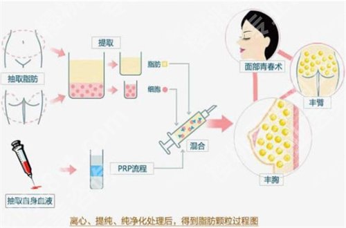 广州仁健医疗美容门诊部怎么样?相关隆鼻科普知识已经讲解