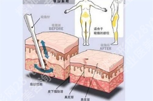 广州联合丽格美容医院院长是谁?看医院核心项目的介绍