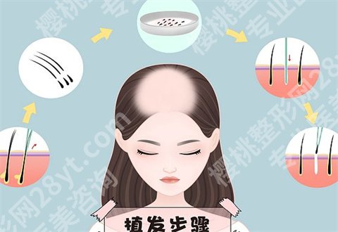 南京鼓楼新生医疗美容门诊部技术咋样?案例真实反馈来了