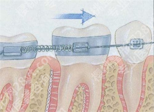 穗华口腔医院牙齿矫正怎么样?好评不断,一键了解详情