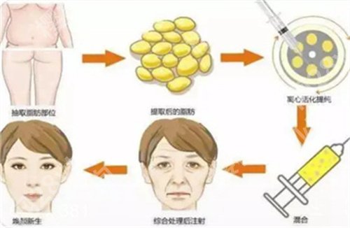 深圳阳光做面部填充好还是非凡好?医院详情介绍,口碑在线看