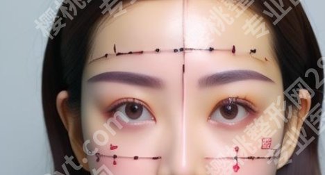 深圳美莱哪个医生做眼睛好?哪位医生做的风格比较自然?
