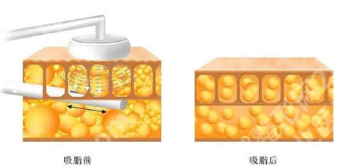 首尔丽格做鼻子哪个医生好?医生团队资源