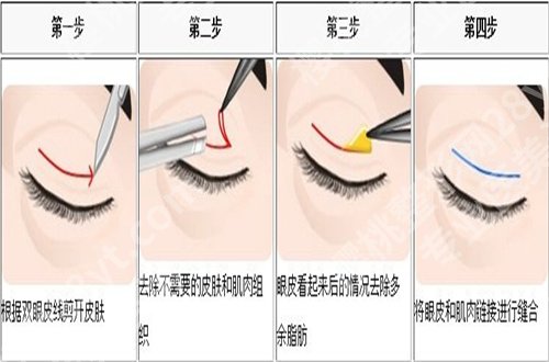 深圳米兰柏羽整形医院怎么样?基本地址+项目介绍来了