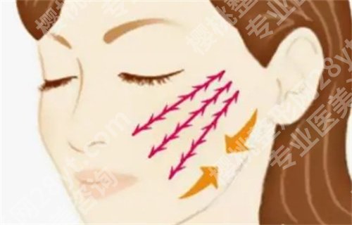 王金州做拉皮怎么样?医生详情介绍,口碑查看