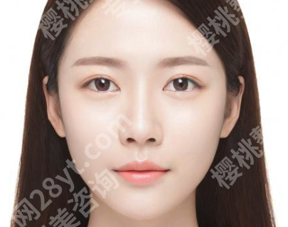 章建林正颌手术怎么样?戳进来看看医生资料与详细案例曝光