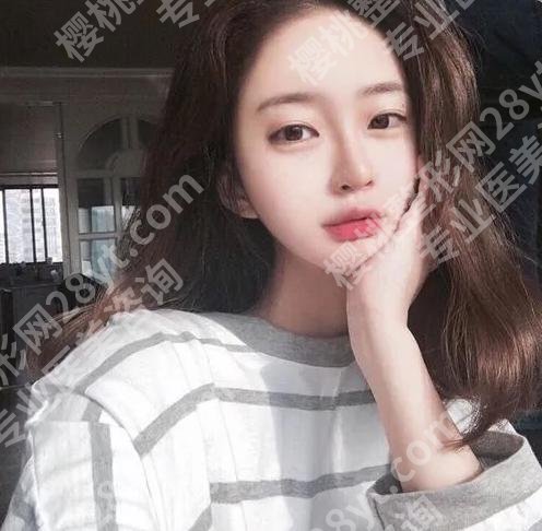 北京大学口腔医院做唇腭裂好不好?速看相关案例过程详情