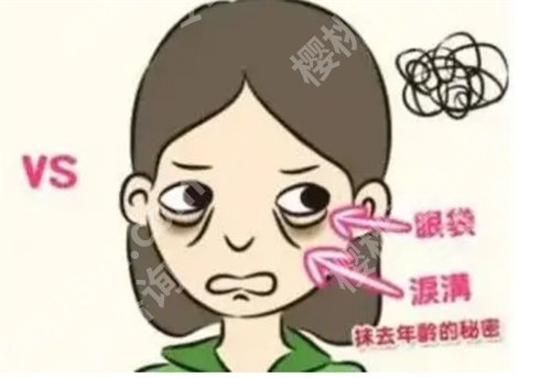 武汉项利姣和汪国民哪个医生做祛眼袋手术好?看技术PK