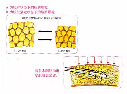 深圳阳光整形医院脂肪填充价格表一览!看人气项目介绍