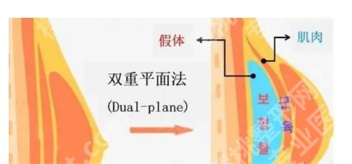 深圳阳光整形医院隆胸价格是多少?看项目定价标准