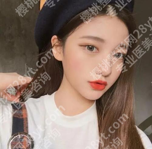 张金辉医生手术案例怎么样?精选案例过程与医生简介分享