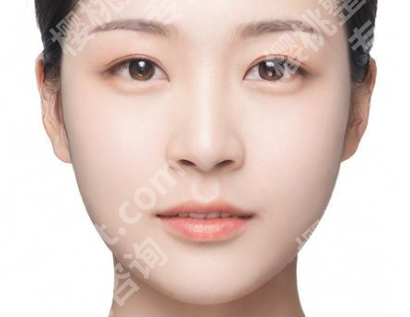 穆雄铮做颧骨好吗?戳进来看看医生信息和网友反馈一览