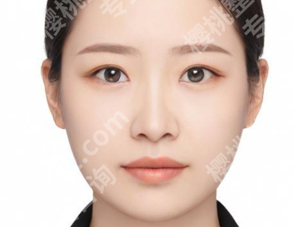 穆雄铮做颧骨好吗?戳进来看看医生信息和网友反馈一览