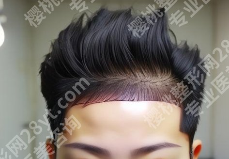 杭州碧莲盛植发医院地址在哪里?医院基本信息披露!顾客点评