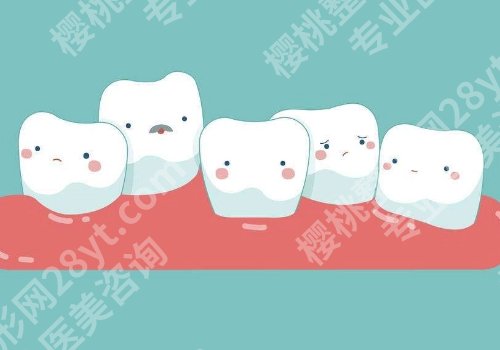 四川华西口腔医院正畸正颌手术多少钱?正畸联合正颌大概10W元左右