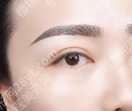沈阳百嘉丽整形医院切眉技术如何?真人效果图展示!