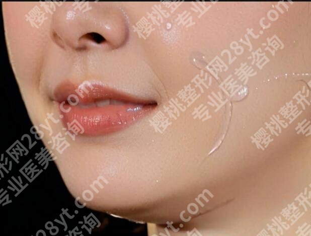 口角囊袋吸脂多少钱?影响费用变动的因素有哪些?戳进来看