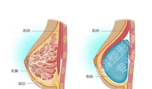 上海中山医院祛疤比较好的医生有谁?项目价格参考