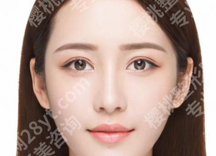 俞哲元医生手术案例怎么样?速看相关案例过程一览