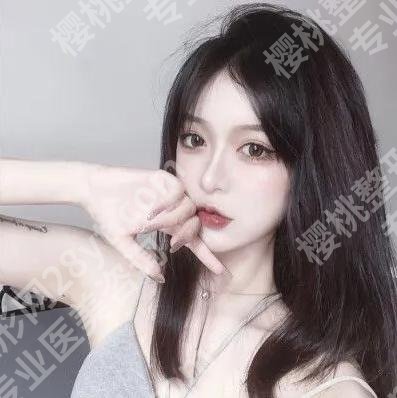 俞哲元医生手术案例怎么样?速看相关案例过程一览