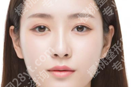 乌丹旦医生的唇裂手术怎么样?了解专家简介与相关案例分享