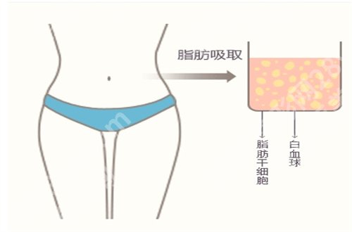 东莞人民医院吸脂哪个医生好?全新资料邀请你查看