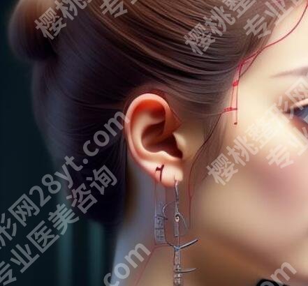 康春雨耳再造怎么样?医生口碑评价|真人体验反馈!