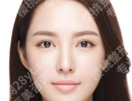 上海美莱游远榕做的鼻子图片怎么样?查看医生资料,含小贴士分享