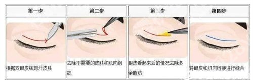沈国雄和徐晓斐谁的技术好?口碑在线点评